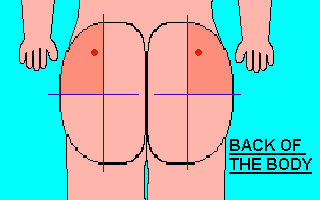 Steroid bum injections