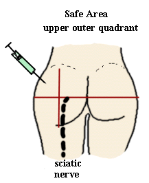 How to self inject steroids in glute