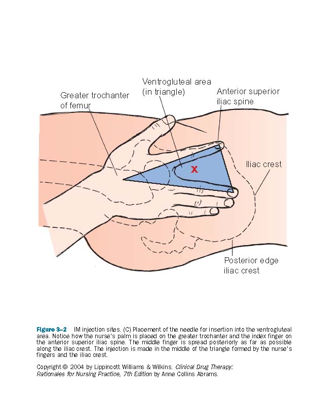 Click image for larger version. 

Name:	Fig03-02C.jpg 
Views:	43418 
Size:	64.4 KB 
ID:	117631