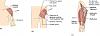 Click image for larger version. 

Name:	Intramuscular Injection Sites.jpg 
Views:	179290 
Size:	114.7 KB 
ID:	125036