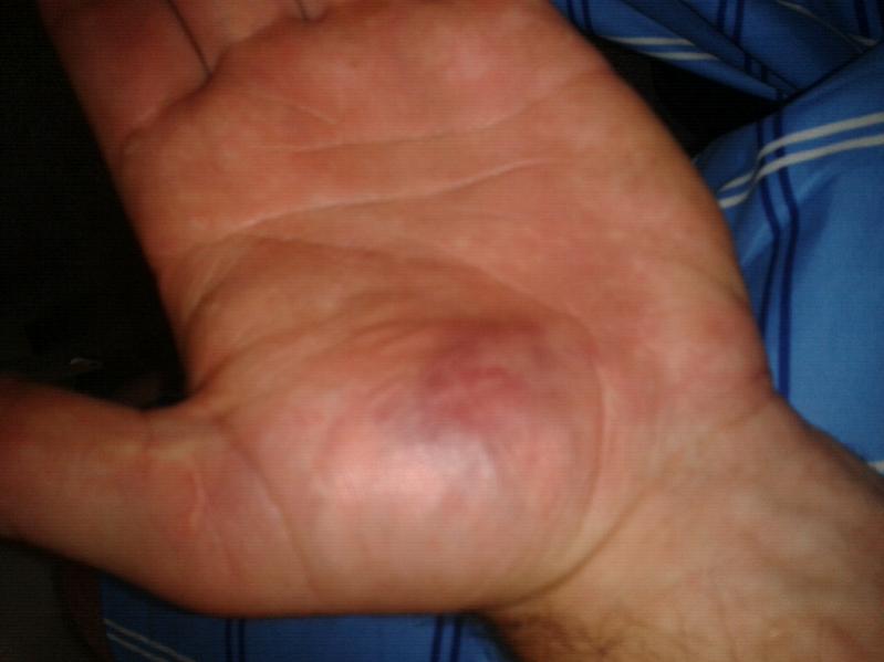 Click image for larger version. 

Name:	ForumRunner_20120806_201300.jpg 
Views:	172 
Size:	33.4 KB 
ID:	125204