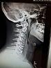 Click image for larger version. 

Name:	neck 2.jpg 
Views:	226 
Size:	82.0 KB 
ID:	138562