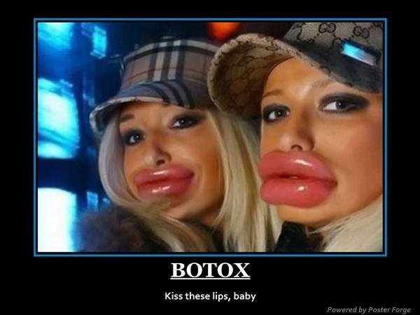 Click image for larger version. 

Name:	botox_369ad7_314966.jpg 
Views:	383 
Size:	32.1 KB 
ID:	152216