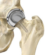 Click image for larger version. 

Name:	BirminghamHip.jpg 
Views:	383 
Size:	6.5 KB 
ID:	153422