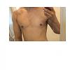 Click image for larger version. 

Name:	Gyno5.jpg 
Views:	84 
Size:	286.6 KB 
ID:	173346