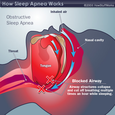 Rest and Heart Health