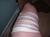 Messed up hamstring for sale... Needs repairs-strapped-up-.jpg