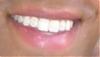 My Teeth.... (picture)-my-teeth.jpg