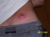 OMG the pain!!!!! (warning pics)-picture-035.jpg