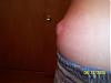 OMG the pain!!!!! (warning pics)-picture-037.jpg
