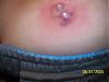 OMG the pain!!!!! (warning pics)-picture-038.jpg