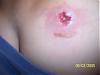 OMG the pain!!!!! (warning pics)-picture-041.jpg