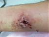 Warning: Fvcking graphic pics!! (brn rcluse SPIDER BITE!!!)-100_0126_640x480.jpg