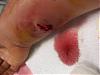 Warning: Fvcking graphic pics!! (brn rcluse SPIDER BITE!!!)-100_0130_640x480.jpg