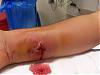 Warning: Fvcking graphic pics!! (brn rcluse SPIDER BITE!!!)-100_0131_640x480.jpg