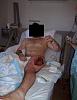 Friend w/ Compartment Syndrome... (Graphic Photos inside)-comp2.jpg