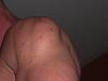 Bizarre Shoulder Problem-cimg2136.jpg