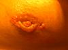 Nipple pic after gyno surgery-2.19.10-089_edited.jpg