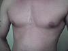 gyno or not?????? pics attached-img000061.jpg