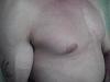 gyno or not?????? pics attached-img000062.jpg