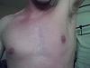 gyno or not?????? pics attached-img000059.jpg
