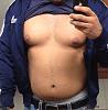 HELP! Is this Gyno or just fat?!?! ^^^PICS^^^ !!!!!-img_5125.jpg