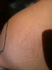 are dissapearing stretch marks normal-forumrunner_20130802_151001.jpg