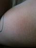 are dissapearing stretch marks normal-forumrunner_20130802_153958.jpg