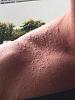 skin problem on cycle photos-image-2949898557.jpg