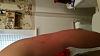 Soft lump in tricep after Delt injection-20150917_161532.jpg