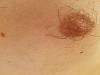 What is wrong with my nips? (Gyno question)-wvduzyw.jpg