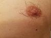 What is wrong with my nips? (Gyno question)-xhejyb3.jpg