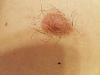 What is wrong with my nips? (Gyno question)-wbjectc.jpg