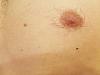 What is wrong with my nips? (Gyno question)-sgvjfhu.jpg