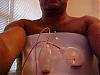 Gyno Surgery and the aftermath-mvc-016s.jpg