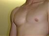 gyno puberty questions w/ pics-nate3a.jpg