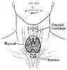 How Your Thyroid Works-largeviewthy1.gif