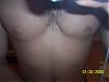gyno question-picture-105.jpg