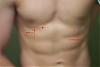 Calling All Experts ! - Possible Gyno? Help Me Figure Out If It Is Or Not! Ahhh-both-pecs2.jpg