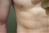 Calling All Experts ! - Possible Gyno? Help Me Figure Out If It Is Or Not! Ahhh-left-pec.jpg