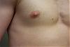 Calling All Experts ! - Possible Gyno? Help Me Figure Out If It Is Or Not! Ahhh-right1.jpg