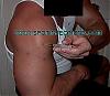 Injection site question?-delt2.jpg