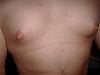 does this look like gyno-picture-020.jpg