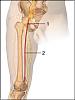 N E 1 Use these spots to inject?-blood-clot-embolus-femoral-artery-leg.jpg