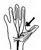 OUCH! Hit nerve in hand!-median-nerve-hand.gif