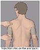 HGH injection guide and site map-hgh-news-subcutaneous-injection-site-arm-back.jpg