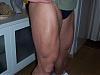 LOG: pre-contest bulk cycle, bringing legs up par with MGF (and other goodies)-leg4.jpg