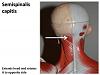 Back of head muscle injury?-4850034219_13dd38a1f9.jpg