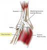 Bicep tendon rupture-2128fig3.jpeg