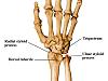 Injury to the styloid process?-wrist-jt.jpg